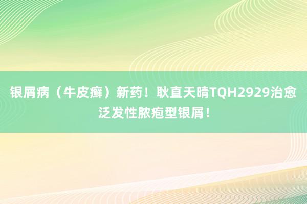 银屑病（牛皮癣）新药！耿直天晴TQH2929治愈泛发性脓疱型银屑！